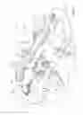 Fig. 02 - Transport device for ossicular prosthesis