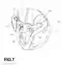 Fig. 08 - Earth moving bucket