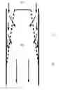 Fig. 01 - Method and system for measuring a flow