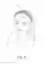 Fig. 07 - HAIR PAD