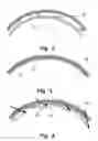 Fig. 03 - Flow restrictor and method for reducing resistance of a flow