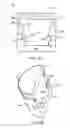 Fig. 04 - Rolling cutter bit design