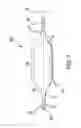Fig. 02 - Method of reducing rigidity of angioplasty balloon sections