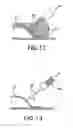 Fig. 07 - Method of reducing rigidity of angioplasty balloon sections