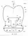 Fig. 06 - Airbag device