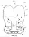 Fig. 08 - Airbag device