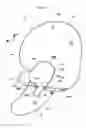Fig. 17 - Airbag device