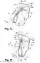 Fig. 09 - Latch assembly, over-center reverse draw