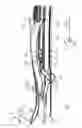 Fig. 04 - Wind deflector