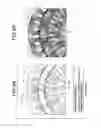 Fig. 09 - Motor provided with two stators arranged radially inside and outside rotor
