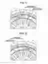 Fig. 12 - Motor provided with two stators arranged radially inside and outside rotor