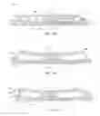 Fig. 14 - Method of manufacturing electroactive polymer transducers for sensory feedback applications