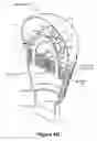 Fig. 17 - SOLID-STATE LIGHT BULB HAVING AN ION WIND FAN AND A HEAT PIPE