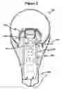 Fig. 03 - Dimmable thermally controlled safety light emitting diode illumination device