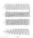 Fig. 03 - Method and device for an induction motor start