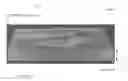 Fig. 01 - Characterization and correction of macular distortion