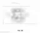 Fig. 10 - Characterization and correction of macular distortion
