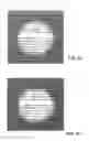 Fig. 11 - Characterization and correction of macular distortion