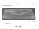Fig. 16 - Characterization and correction of macular distortion