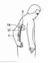Fig. 01 - ADJUSTABLE LIQUID-WIPING DEVICE