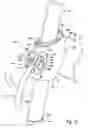Fig. 03 - Apparatus for positioning a component of an exercise device