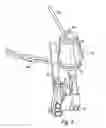 Fig. 04 - Device for winching