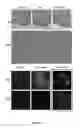 Fig. 02 - Human soluble CD146, preparation and uses thereof