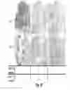 Fig. 83 - INTERFERON ALPHA-INDUCED PHARMACODYNAMIC MARKERS