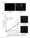 Fig. 02 - PROSTATE CANCER PROGRESSION INHIBITOR AND PROGRESSION INHIBITION METHOD