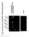 Fig. 05 - Mutant ROS expression in human cancer