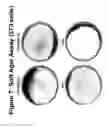 Fig. 08 - Mutant ROS expression in human cancer