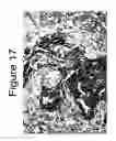 Fig. 19 - Mutant ROS expression in human cancer