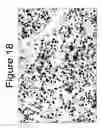 Fig. 20 - Mutant ROS expression in human cancer
