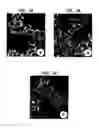 Fig. 04 - Diagnostic method for diseases by screening for hepcidin in human or animal tissues, blood or body fluids and therapeutic uses therefor