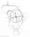 Fig. 01 - REMOVAL DEVICE FOR REMOVING ADHERENT