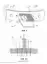 Fig. 06 - Tennis racquet with replaceable playing surface