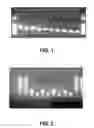 Fig. 02 - METHODS AND COMPOSITIONS TO DETECT CLOSTRIDIUM DIFFICILE