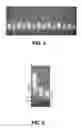 Fig. 04 - METHODS AND COMPOSITIONS TO DETECT CLOSTRIDIUM DIFFICILE