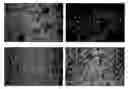 Fig. 01 - Treatment of renal dysfunction and multiple myeloma using PACAP compounds