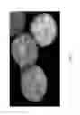 Fig. 02 - APO-LIPOPROTEIN PROPEPTIDE
