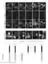 Fig. 22 - Method of protecting against heart failure