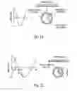 Fig. 09 - Device, system, and method for a stress sensing medical needle