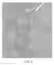 Fig. 07 - Imaging of biological structures by changing the position or distance of the structures between a source and a detector