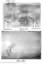 Fig. 08 - Imaging of biological structures by changing the position or distance of the structures between a source and a detector
