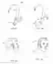 Fig. 05 - Systems and methods for reducing subconscious neuromuscular tension including bruxism