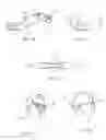 Fig. 08 - Systems and methods for reducing subconscious neuromuscular tension including bruxism