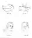 Fig. 10 - Systems and methods for reducing subconscious neuromuscular tension including bruxism