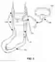 Fig. 02 - AMBULATORY NEGATIVE PRESSURE THERAPEUTICAL COMPRESSION DEVICE