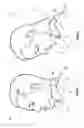 Fig. 02 - Dynamically reactive spinal support system