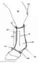 Fig. 01 - Therapeutic joint support for animals